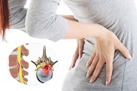 Cách chữa đau thắt lưng đau lưng dưới khỏi dứt điểm