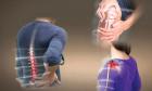 Xẹp đốt sống: Nguyên nhân, triệu chứng, chẩn đoán và điều trị