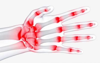 Viêm khớp nỗi lo âu của người lớn tuổi . Nguyên Nhân Và Cách Điều Trị
